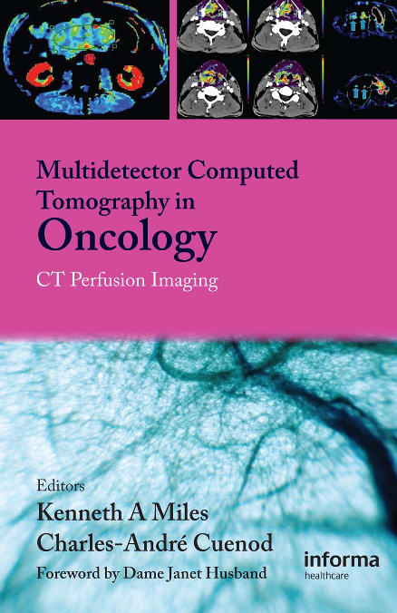 Multidetector Computed Tomography in Oncology.pdf