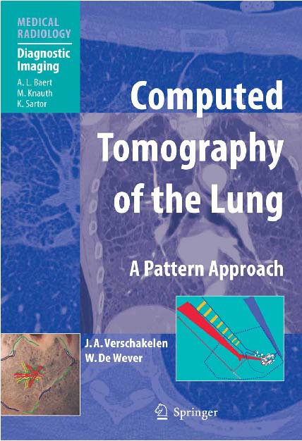 Computed_Tomography_of_the_Lung.pdf