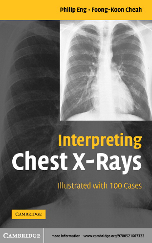 InterpretingChestX-Rays.pdf