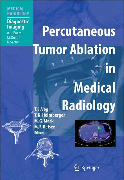 放射医学（医学放射影像诊断经皮肿瘤消融术Percutaneous Tumor Ablation in Medical Radiology.pdf