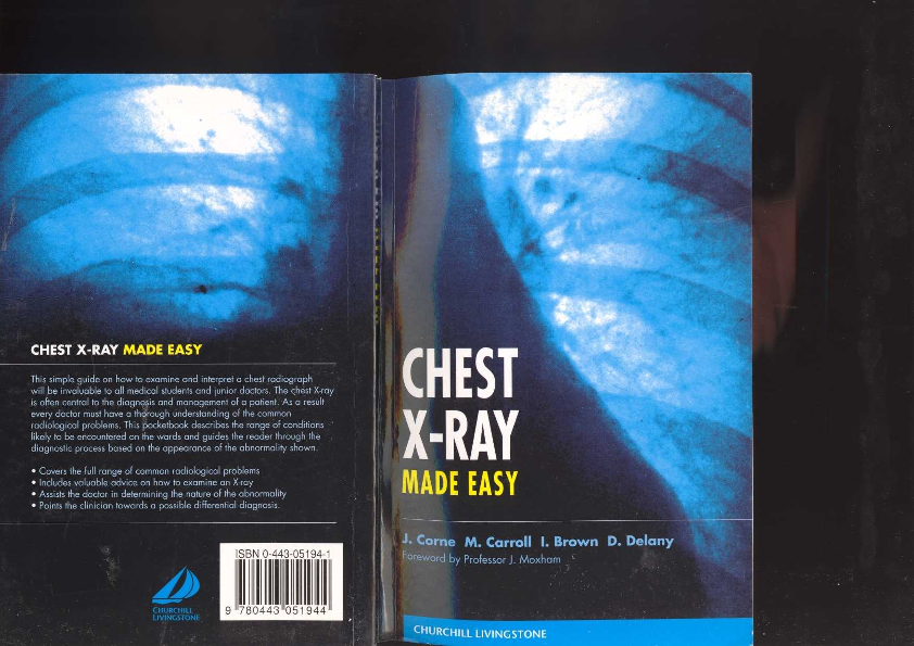 Chest X-Ray Made Easy.pdf