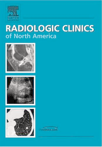 2009, Vol.47, Issues 2, Imaging of Airway Diseases.pdf
