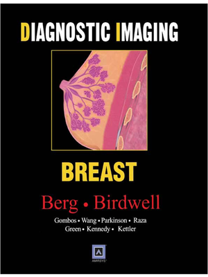 Diagnostic Imaging - Breast.pdf