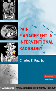 Pain Management in Interventional Radiology.pdf