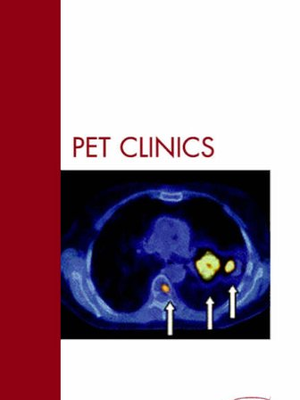 Lung Cancer, An Issue of PET Clinics - Fletcher.pdf