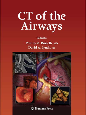CT of the airways.PDF