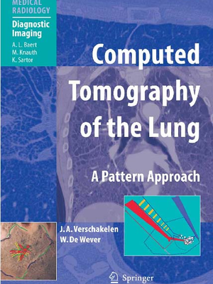 Computed_Tomography_of_the_Lung.pdf