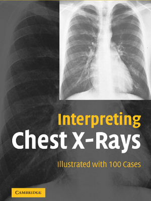 InterpretingChestX-Rays.pdf