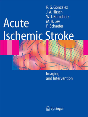 急性缺血性脑卒中的影像与介入－05版Acute_Ischemic_Stroke_-_Imaging_and_Intervention.pdf