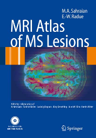 MRI Atlas of MS Lesions.pdf