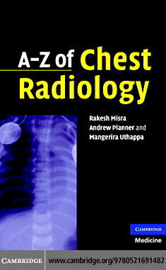 A_Z_of_Chest_Radiology.pdf