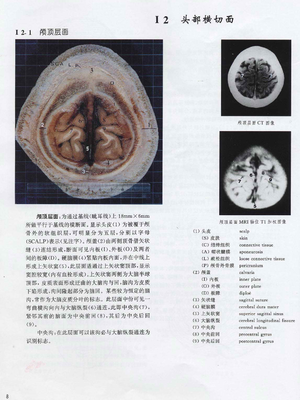 人体断层解剖 CT MRI应用.pdf