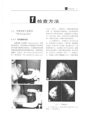 乳腺疾病影像诊断学.pdf